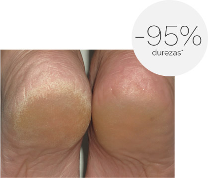 Ureadin Podos Gel Oil 75ML durezas