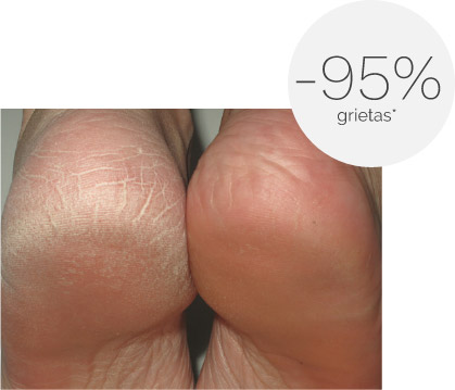 Ureadin Podos Gel Oil 75ML grietas